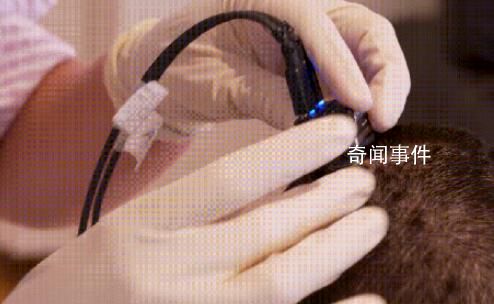 腦機接口,幫人開口
