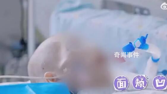 那些因厭食癥差點死掉的女孩 厭食癥到底是種怎樣的疾病