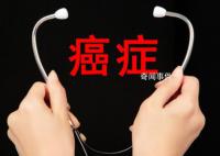 50歲以下人群癌癥新發病例數激增 比1990年增長了79%