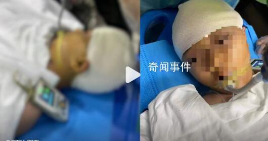打破學生頭骨老師停職接受公安調(diào)查 受傷學生已及時送醫(yī)治療