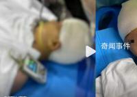 打破學(xué)生頭骨老師停職接受公安調(diào)查 受傷學(xué)生已及時(shí)送醫(yī)治療