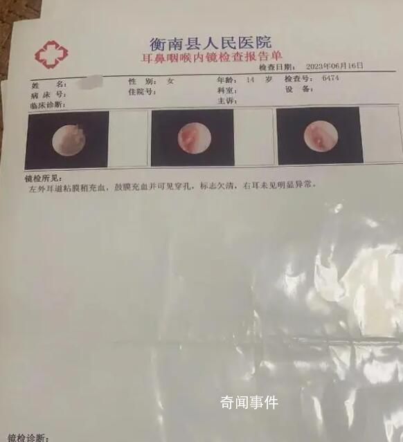 學(xué)生被老師掌摑耳膜穿孔?學(xué)校回應(yīng)
