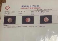 學生被老師掌摑耳膜穿孔?學校回應