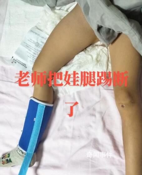 陜西一學(xué)生被老師踢斷腿骨?官方回應(yīng)