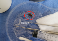 男子半夜臥床玩手機蟑螂鉆進耳朵 傳來一陣劇烈的疼痛