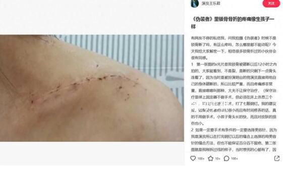 胡歌被曝拍偽裝者時砸斷女主鎖骨 并怒懟胡歌粉絲