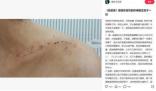 胡歌被曝拍偽裝者時砸斷女主鎖骨 并怒懟胡歌粉絲