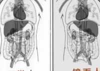 女子就醫發現五臟六腑全長反 什么是鏡面人