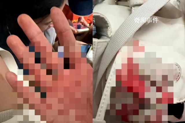 中國游客遇襲身亡:原計劃凌晨回國