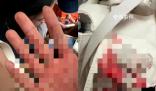 中國游客遇襲身亡:源計劃凌晨回國