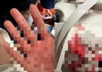 中國游客遇襲身亡:源計劃凌晨回國