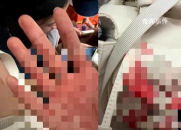 中國游客遇襲身亡:源計劃凌晨回國