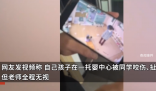 女童在托嬰中心遭同學拽頭發咬傷 因老師的視角問題沒有第一時間看到