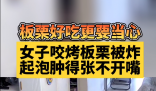 女子吃烤栗子被炸嘴腫得張不開 商家顧客都有點虎
