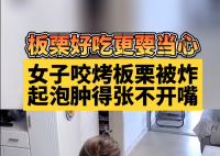 女子吃烤栗子被炸嘴腫得張不開(kāi) 商家顧客都有點(diǎn)虎
