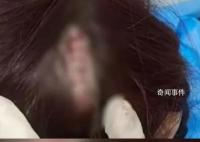 女子在景區提醒禁練鐵頭功處撞破頭