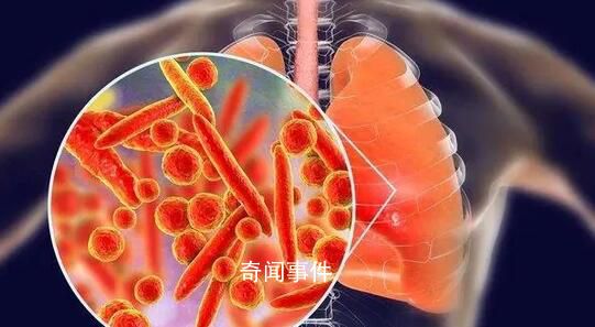 肺炎支原體感染迎來高峰?醫(yī)生回應(yīng)
