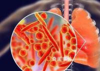 肺炎支原體感染迎來高峰?醫生回應