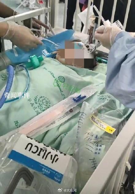 專家談狗咬女童事件:不應搞株連