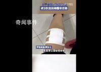 女子帶娃路過公園 被3條流浪狗圍攻