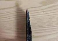 女子稱被手機自燃燒傷 榮耀回應