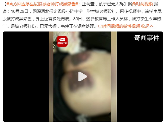 官方調(diào)查學(xué)生屁股被老師打成黑紫色 事件正在調(diào)查處理