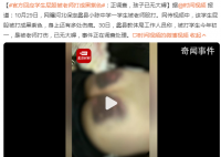 官方調查學生屁股被老師打成黑紫色 事件正在調查處理