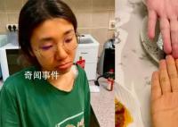 女子為減肥連吃3月胡蘿卜變小橘人