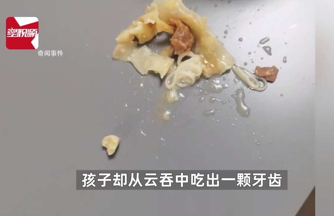 孩子在云吞中吃出牙齒?家長投訴