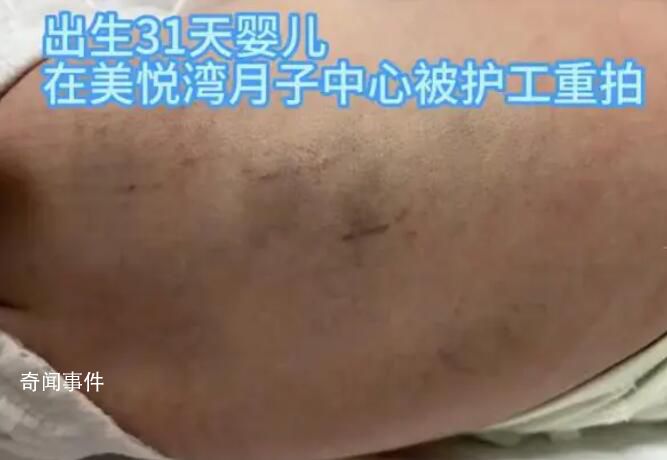 陜西月子會所護工把嬰兒打成腦損傷