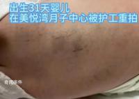 陜西月子會所護工把嬰兒打成腦損傷