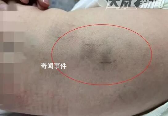 育嬰師拍打嬰兒被拘15天 警方調查中