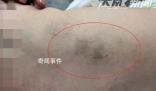 育嬰師拍打嬰兒被拘15天 警方調(diào)查中