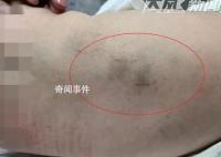 育嬰師拍打嬰兒被拘15天 警方調(diào)查中