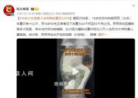 16歲少女患十余種病體重22斤