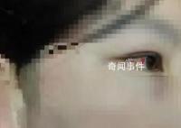 “女兒被打父親萬元懸賞尋兇”追蹤