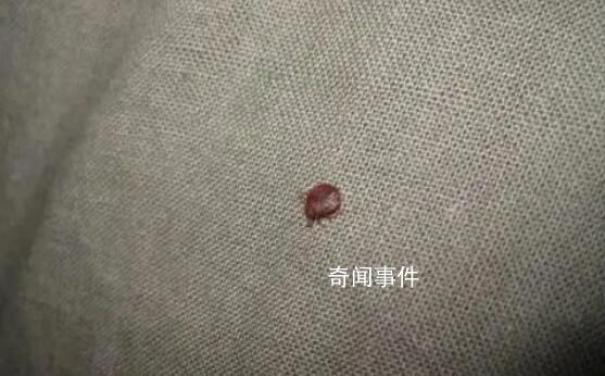 多國爆發床虱危機 已蔓延至亞洲