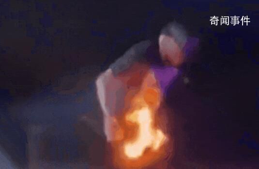歌手演出被噴火裝置射中褲襠 已對傷口進(jìn)行處理