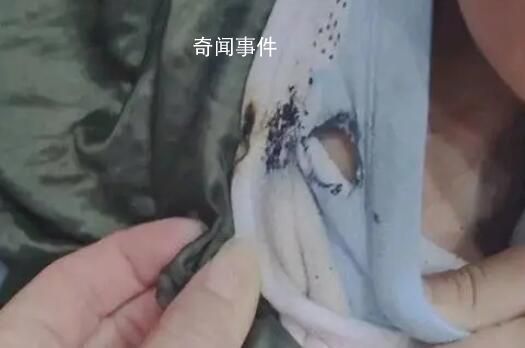 天降煙頭6歲男童棉衣被燙穿 差點燒傷到了皮膚