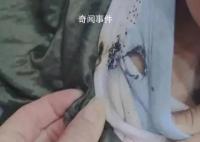 天降煙頭6歲男童棉衣被燙穿 差點(diǎn)燒傷到了皮膚