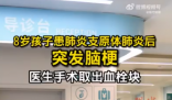 8歲男孩患肺炎支原體肺炎后突發腦梗 最終通過手術治療小寶轉危為安