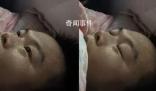 男子同時患甲流支原體燒到額頭冒煙 網(wǎng)友：這下CPU要被干燒了