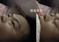男子同時患甲流支原體燒到額頭冒煙 網友：這下CPU要被干燒了
