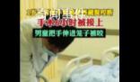 男童手臂伸進(jìn)籠子被藏獒咬斷 手術(shù)差不多花了6個(gè)小時(shí)