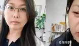 女子自稱20天內“老了30多歲” 引發網友關注