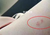 旅客稱花2500元住酒店被蛇咬 事發房間已經封鎖