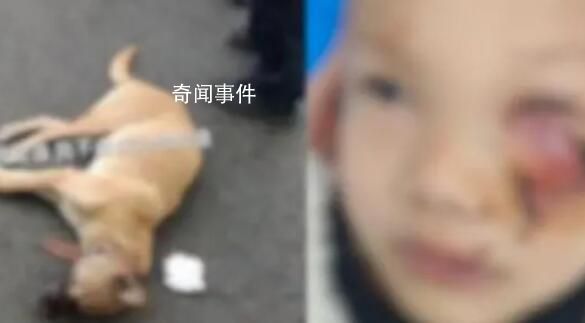 8歲男童遭狗撲咬 臉上縫了90多針