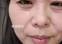 斷崖式衰老女子本以為能漂亮過余生 引發網友熱議