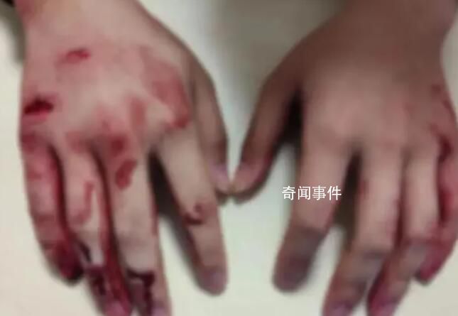 浙江“00后”小伙勇救車禍中母子