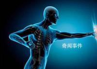 紅斑狼瘡致殘致死率較高 紅斑狼瘡重癥救治的可能有多大